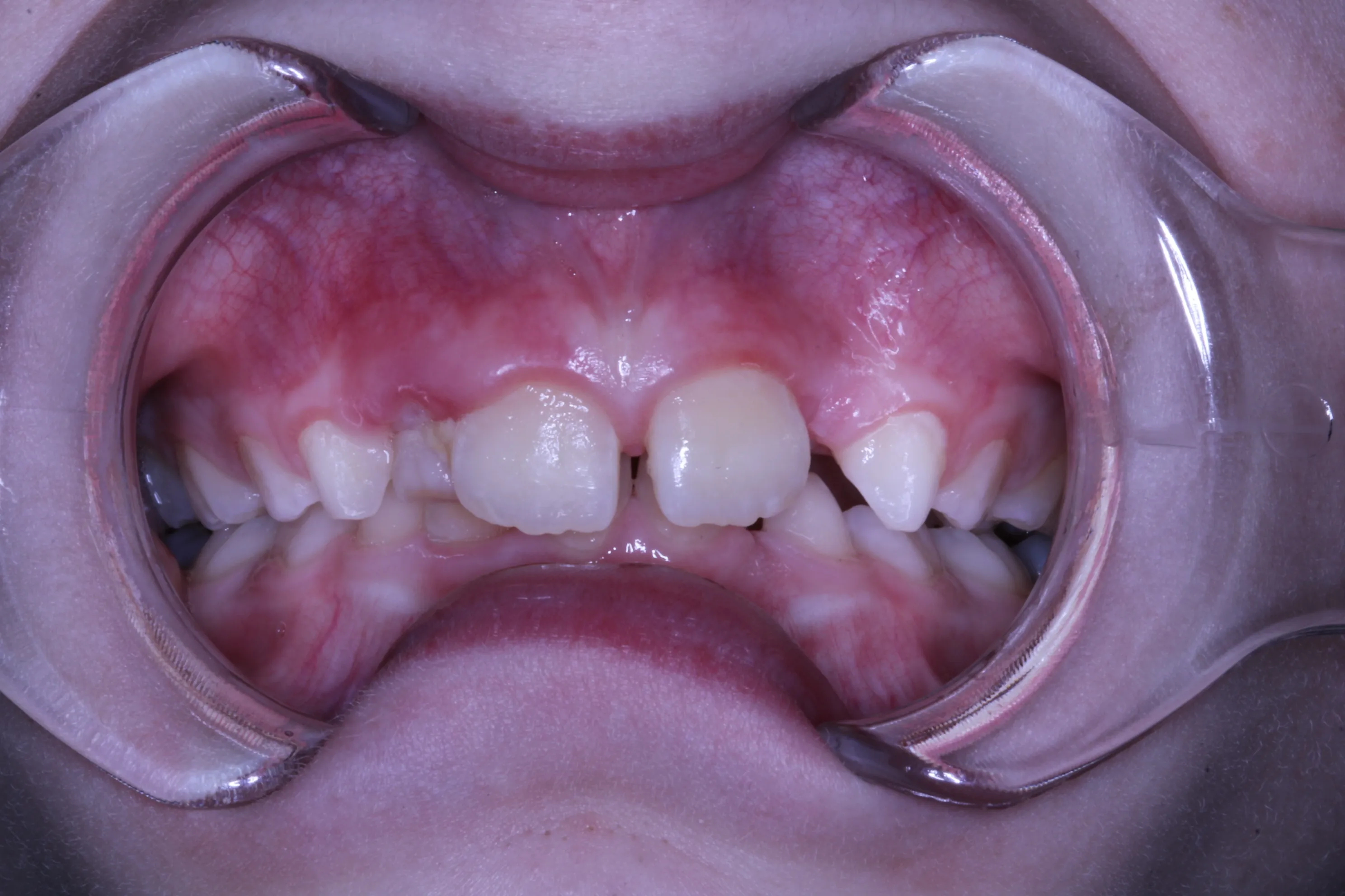 smile-gallery gallery